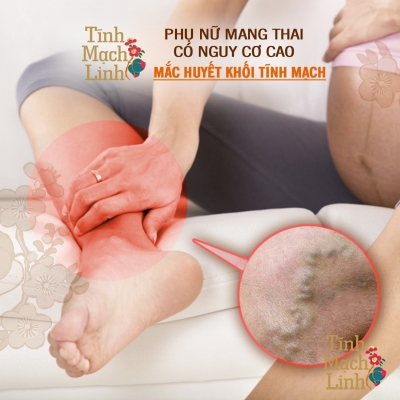 Mối liên hệ giữa huyết khối tĩnh mạch và thai kì ở nữ giới