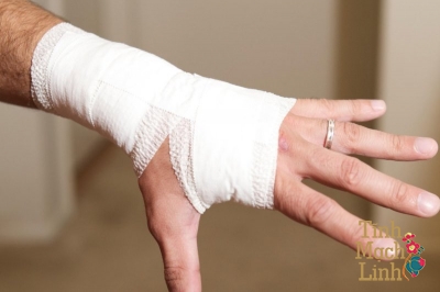 Phẫu thuật hội chứng ống cổ tay cần lưu ý điều gì?