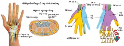 Mổ hội chứng ống cổ tay và những điều bất kì ai cũng phải biết
