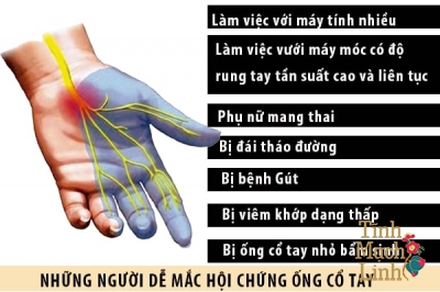 Hội chứng ống cổ tay mức độ trung bình có cần điều trị không?