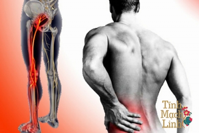 Hay bị tê chân trái là bệnh gì? Có phòng tránh được không?
