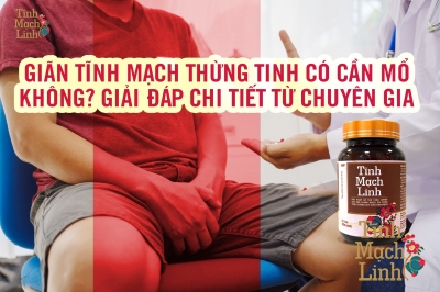 Giãn Tĩnh Mạch Thừng Tinh Có Cần Mổ Không? Giải Đáp Chi Tiết Từ Chuyên Gia