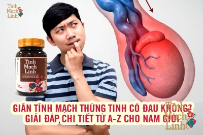 Giãn tĩnh mạch thừng tinh có đau không? Giải đáp chi tiết từ A–Z cho nam giới