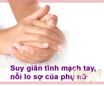 Bệnh suy giãn tĩnh mạch tay là gì? Nguyên nhân, triệu chứng và cách điều trị hiệu quả