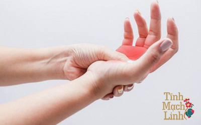 Bạn có biết: Tê tay chân khi ngủ tiềm ẩn 7 hiểm họa khó lường