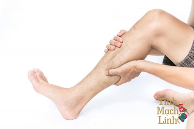 Phương pháp chẩn đoán và điều trị huyết khối tĩnh mạch sâu