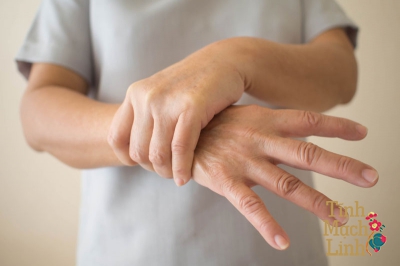 Những điều cần biết về tổn thương thần kinh gây tê bì chân tay sau hóa trị