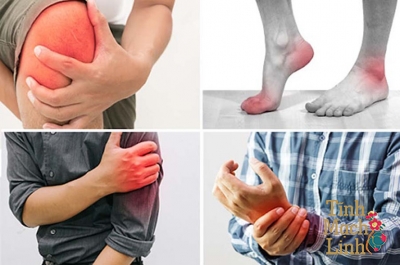 Thuốc trị tê bì chân tay: Hiểu biết đúng, hiệu quả cao