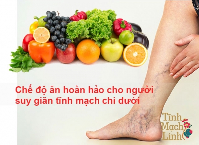 Chế độ ăn hoàn hảo cho người suy giãn tĩnh mạch chi dưới 