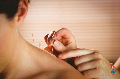 Mách bạn 4 cách chữa tê bì chân tay sau tai biến hiệu quả bất ngờ